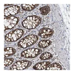 Atlas Antibodies Anti-PNPT1 Antibody