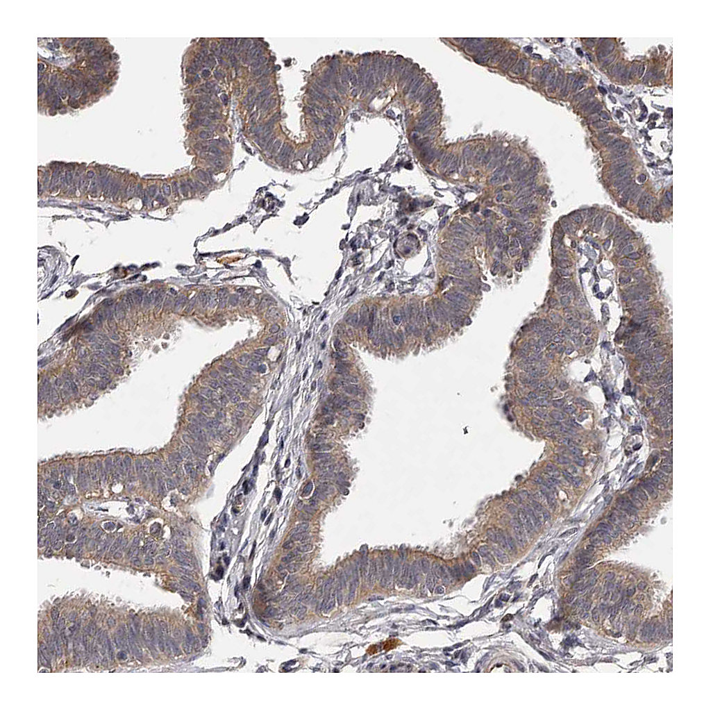 Atlas Antibodies Anti-PNRC1 Antibody
