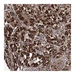 Atlas Antibodies Anti-POC5 Antibody