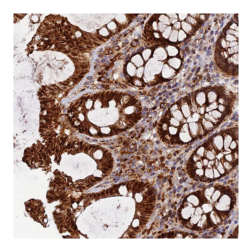 Atlas Antibodies Anti-PODNL1 Antibody