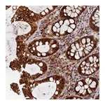 Atlas Antibodies Anti-PODNL1 Antibody
