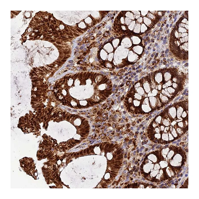 Atlas Antibodies Anti-PODNL1 Antibody