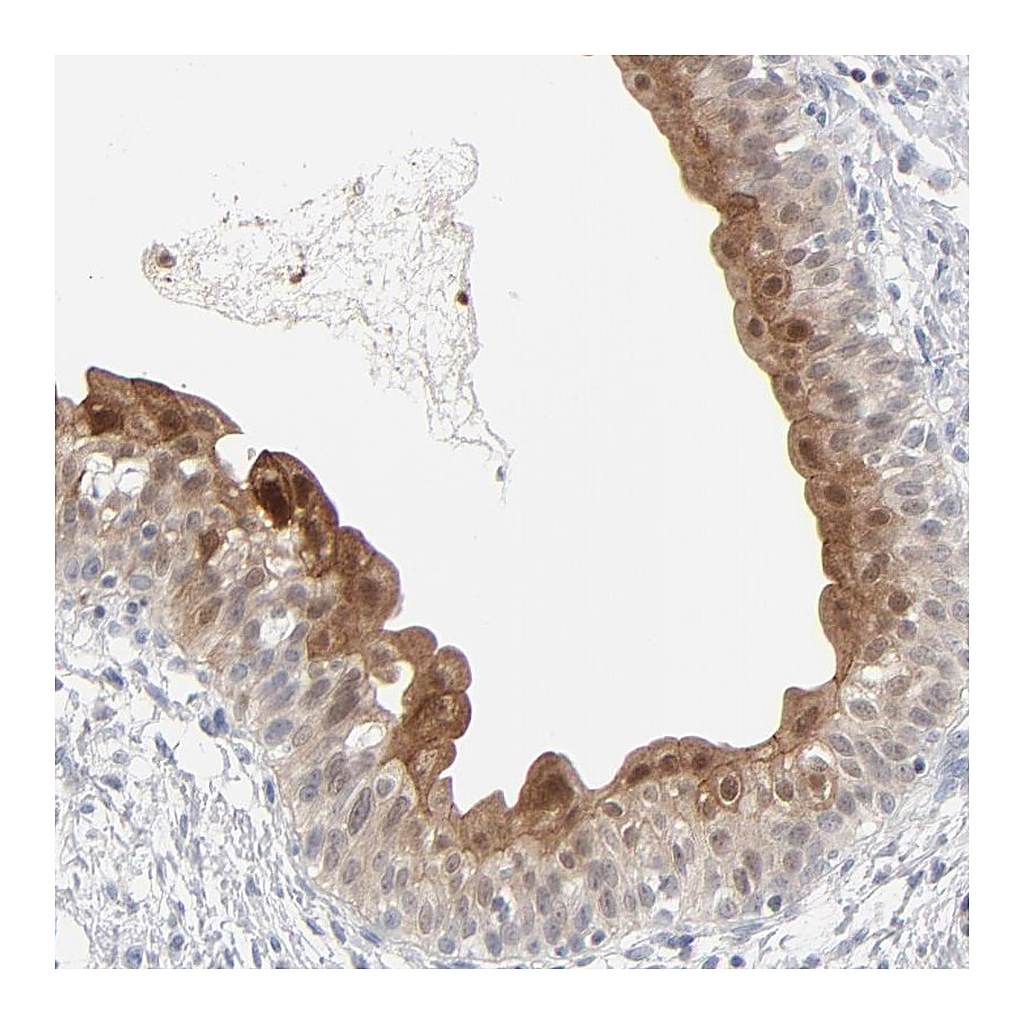 Atlas Antibodies Anti-POF1B Antibody