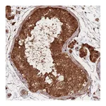 Atlas Antibodies Anti-PODXL2 Antibody