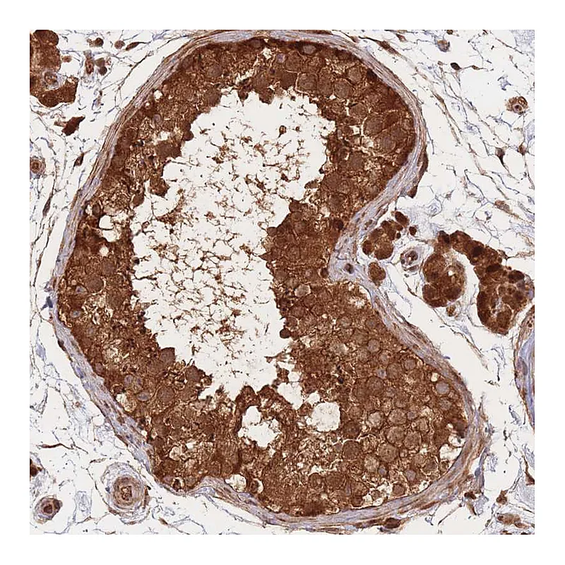 Atlas Antibodies Anti-PODXL2 Antibody