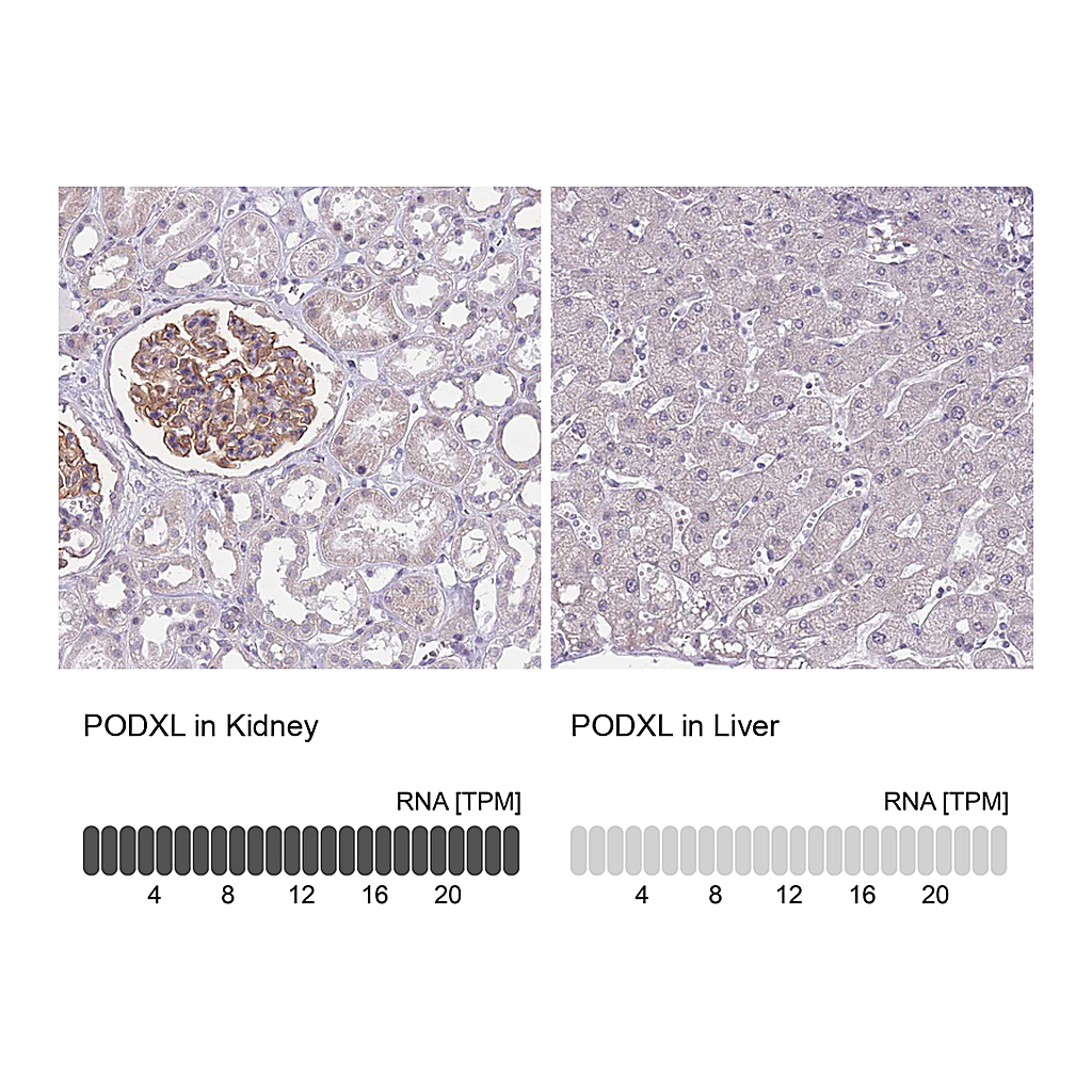 Atlas Antibodies Anti-PODXL Antibody