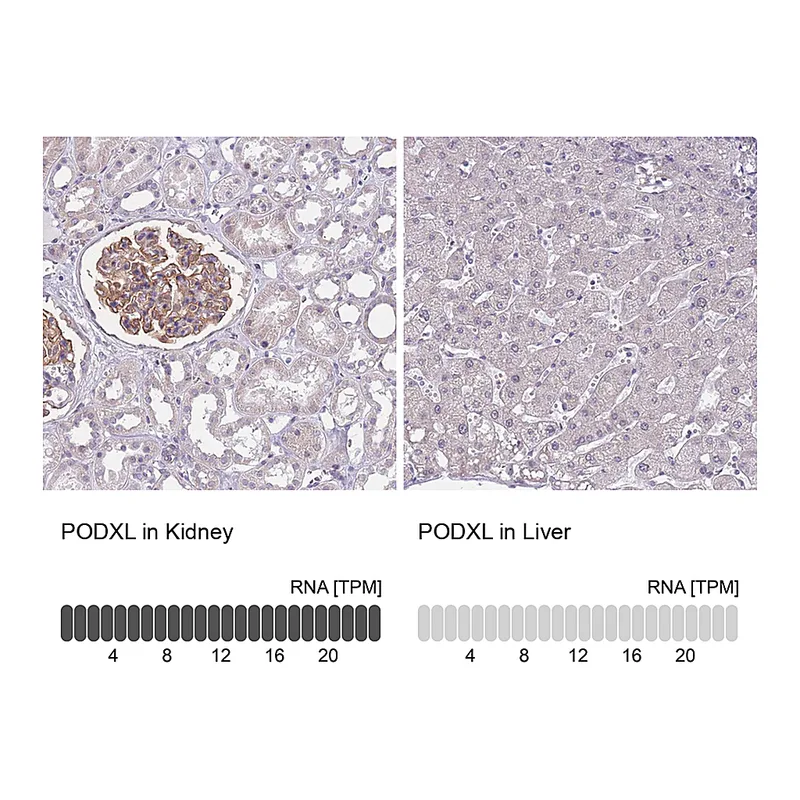 Atlas Antibodies Anti-PODXL Antibody