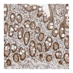 Atlas Antibodies Anti-POGK Antibody