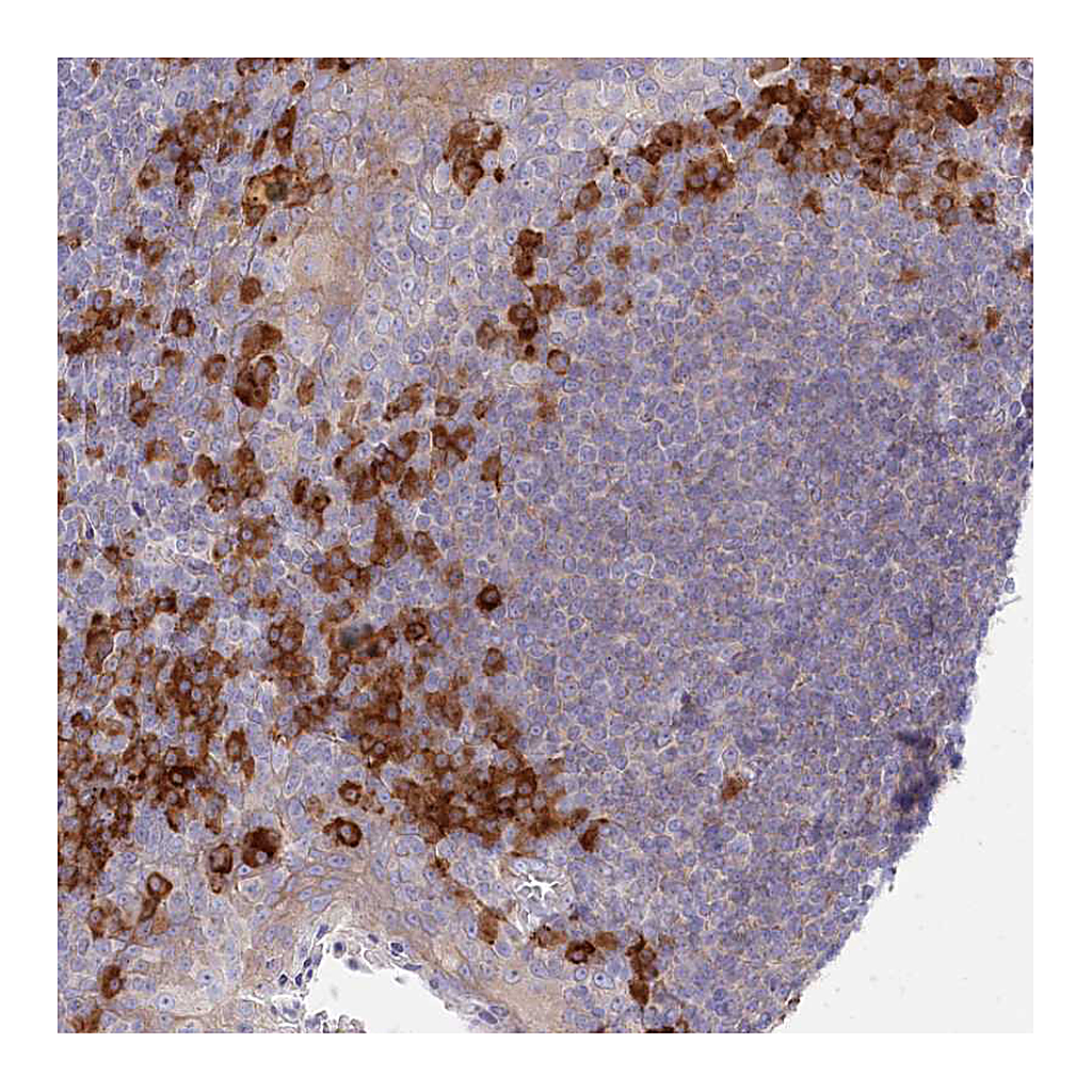 Atlas Antibodies Anti-POGLUT1 Antibody