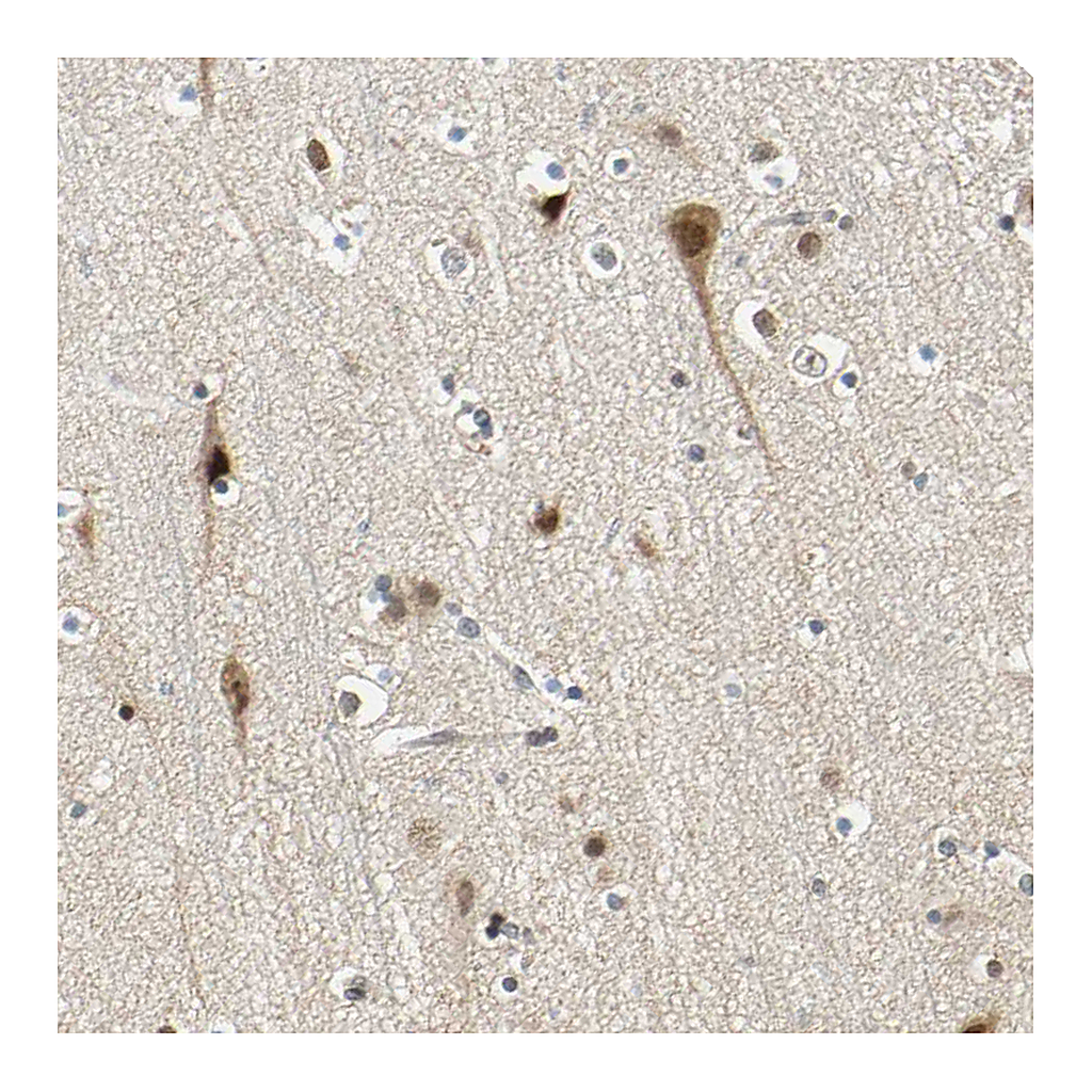 Atlas Antibodies Anti-POGZ Antibody