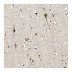 Atlas Antibodies Anti-POGZ Antibody