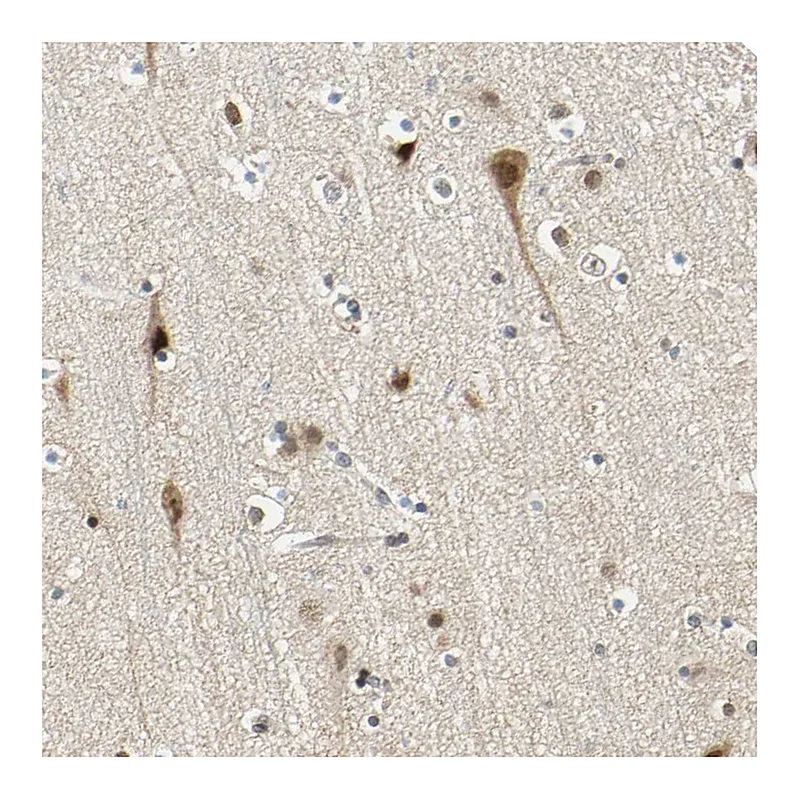Atlas Antibodies Anti-POGZ Antibody