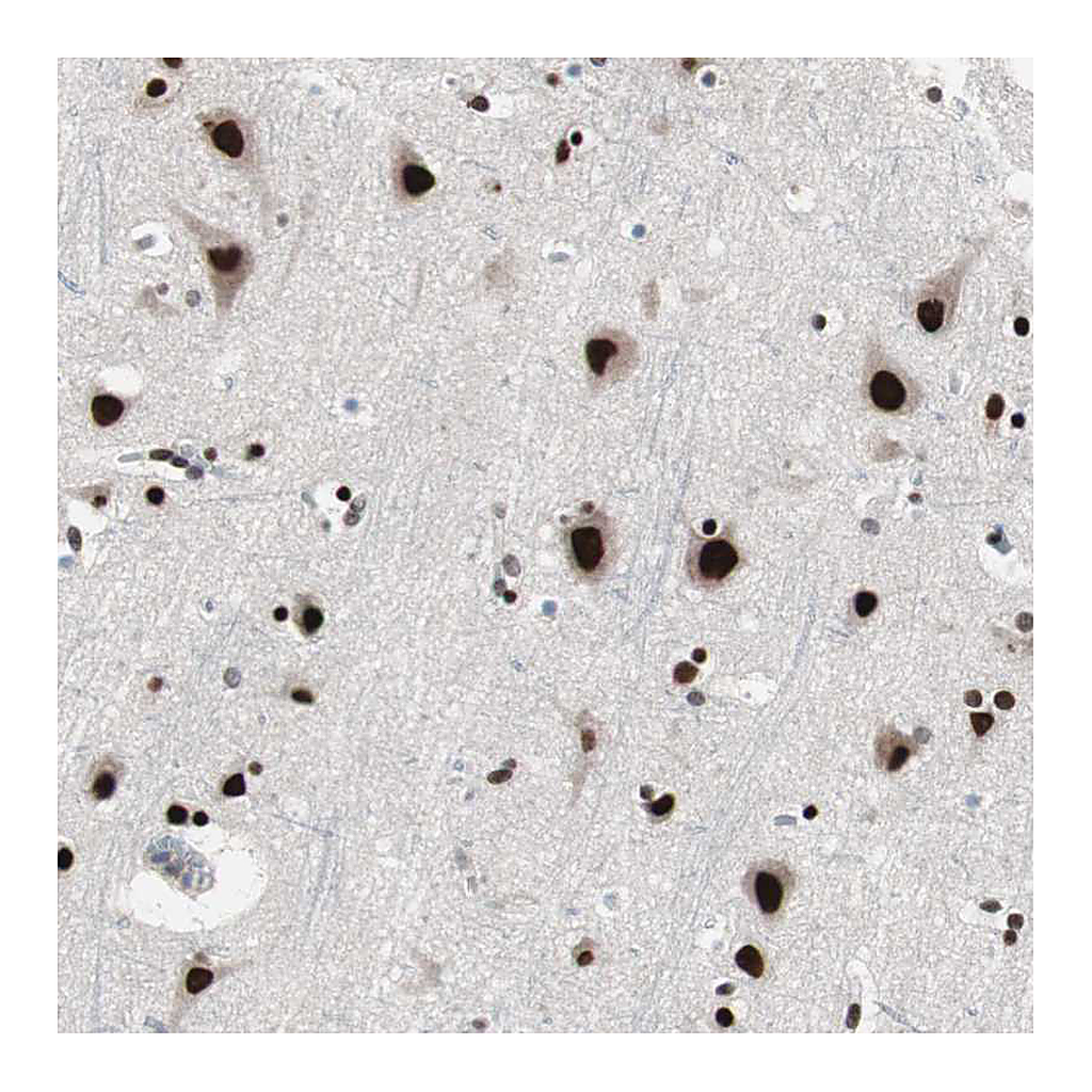 Atlas Antibodies Anti-POGZ Antibody