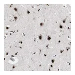 Atlas Antibodies Anti-POGZ Antibody