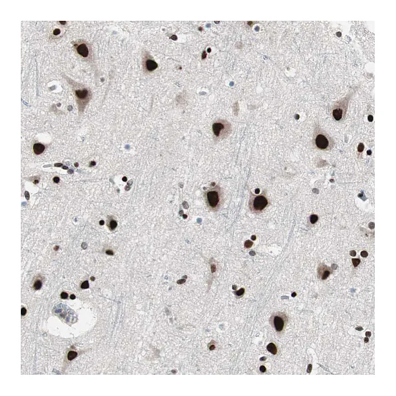 Atlas Antibodies Anti-POGZ Antibody