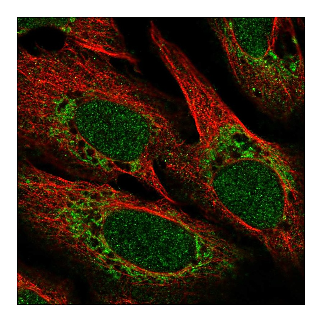 Atlas Antibodies Anti-POLD4 Antibody