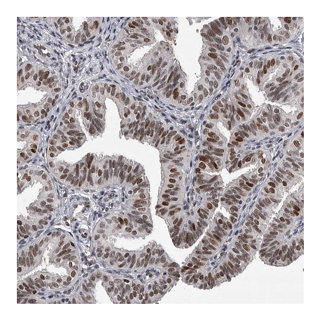 Atlas Antibodies Anti-POLD2 Antibody