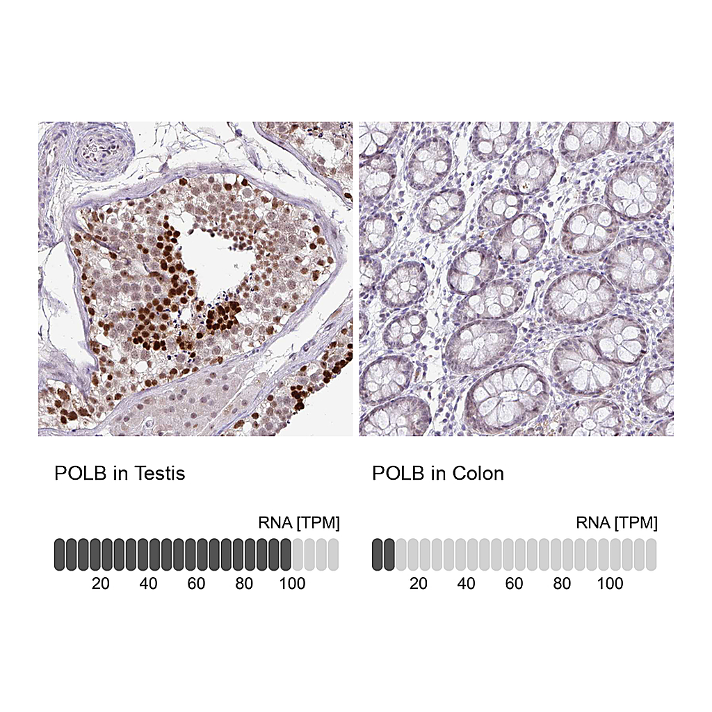 Atlas Antibodies Anti-POLB Antibody