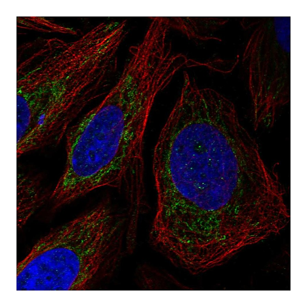 Atlas Antibodies Anti-POLDIP2 Antibody