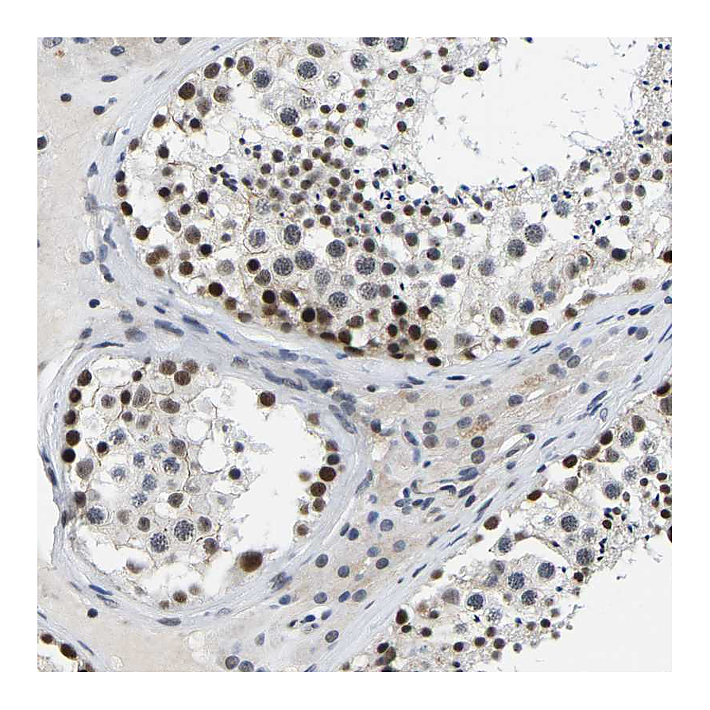 Atlas Antibodies Anti-POLDIP3 Antibody