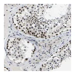 Atlas Antibodies Anti-POLDIP3 Antibody