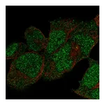 Atlas Antibodies Anti-POLE Antibody