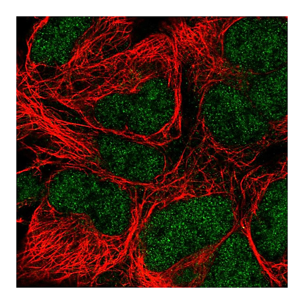 Atlas Antibodies Anti-POLE Antibody