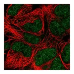 Atlas Antibodies Anti-POLE Antibody