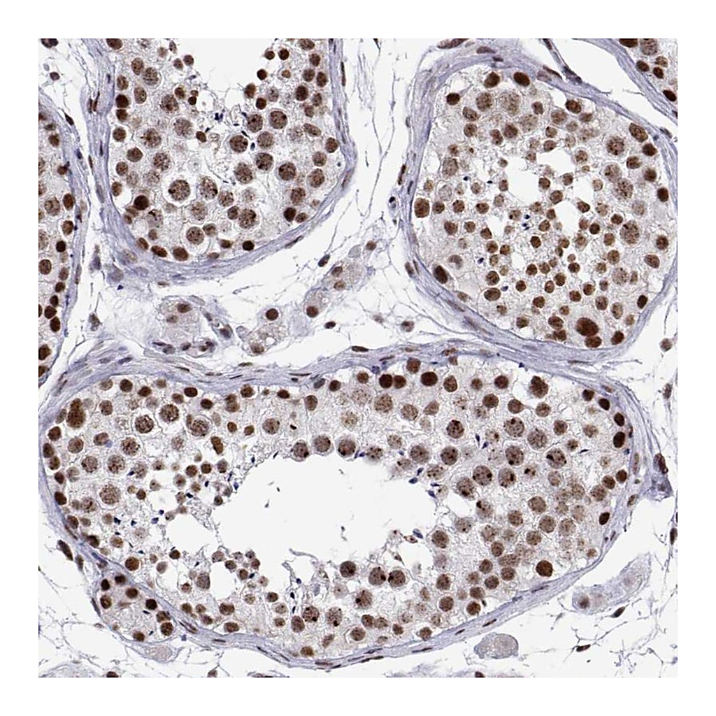Atlas Antibodies Anti-POLDIP3 Antibody