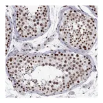 Atlas Antibodies Anti-POLDIP3 Antibody