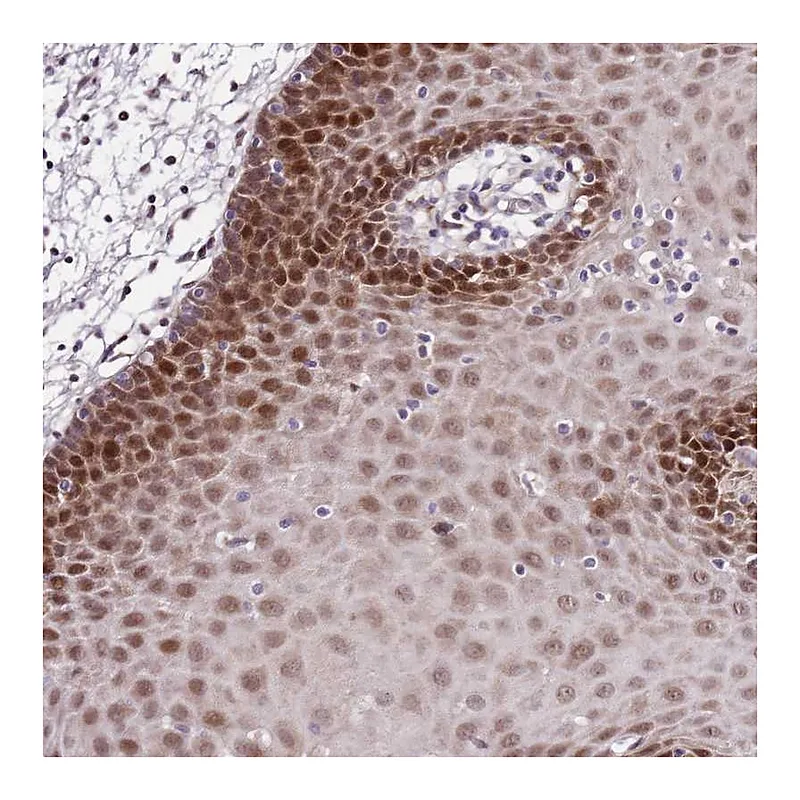 Atlas Antibodies Anti-POLE3 Antibody