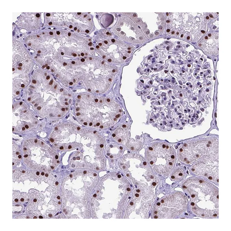 Atlas Antibodies Anti-POLE4 Antibody