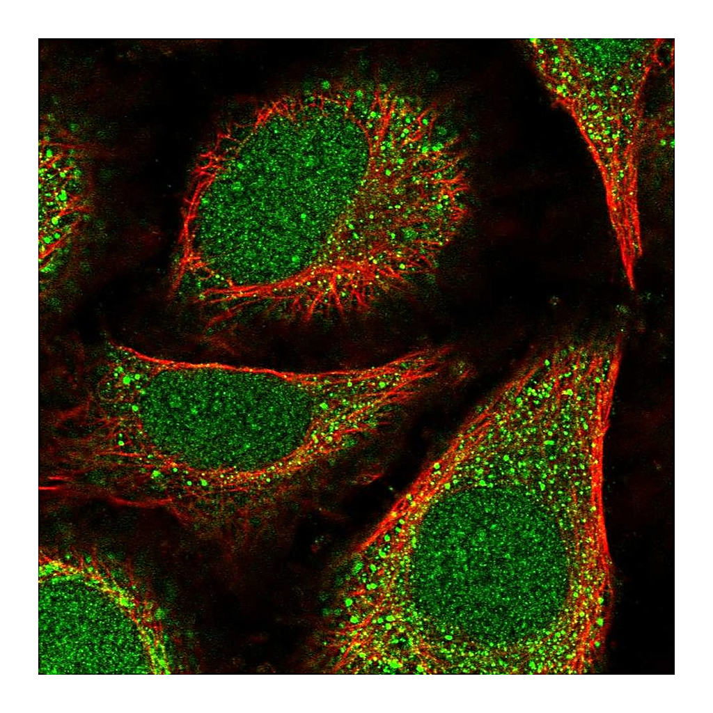Atlas Antibodies Anti-POLE4 Antibody