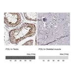 Atlas Antibodies Anti-POLI Antibody