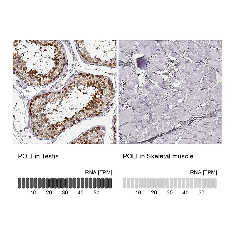 Atlas Antibodies Anti-POLI Antibody