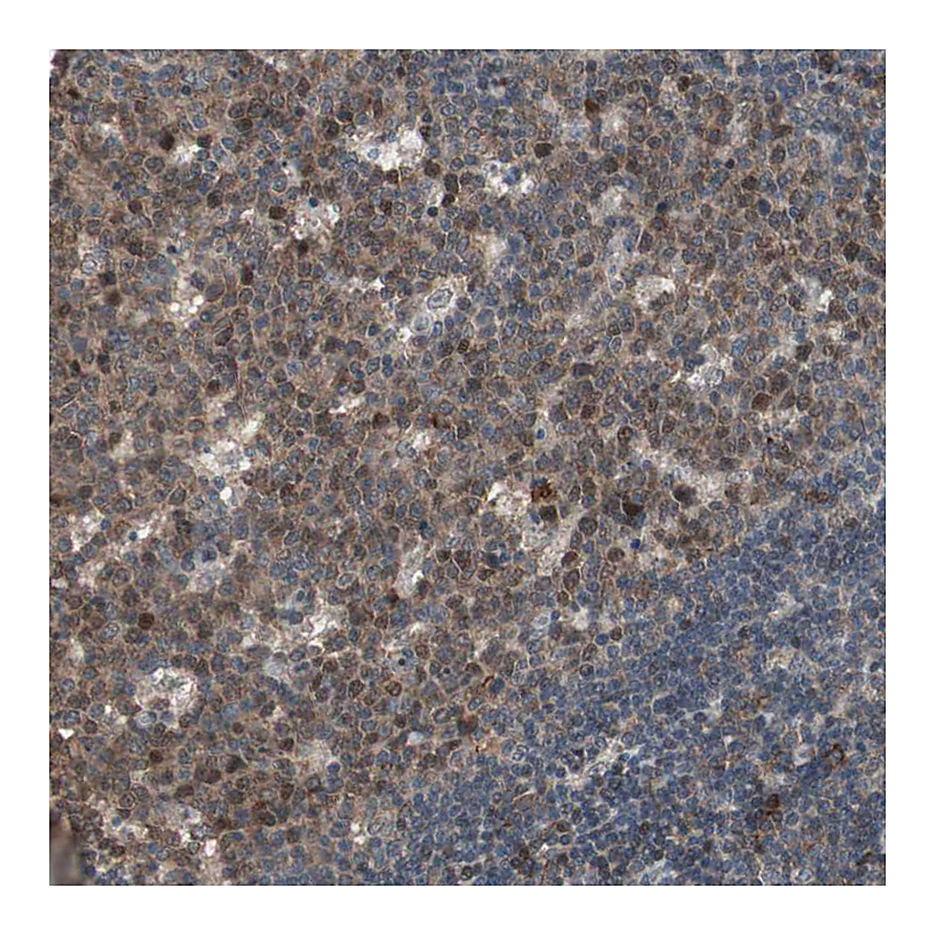 Atlas Antibodies Anti-POLH Antibody
