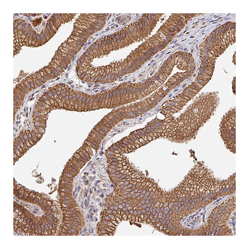 Atlas Antibodies Anti-POLG Antibody