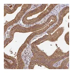 Atlas Antibodies Anti-POLG Antibody