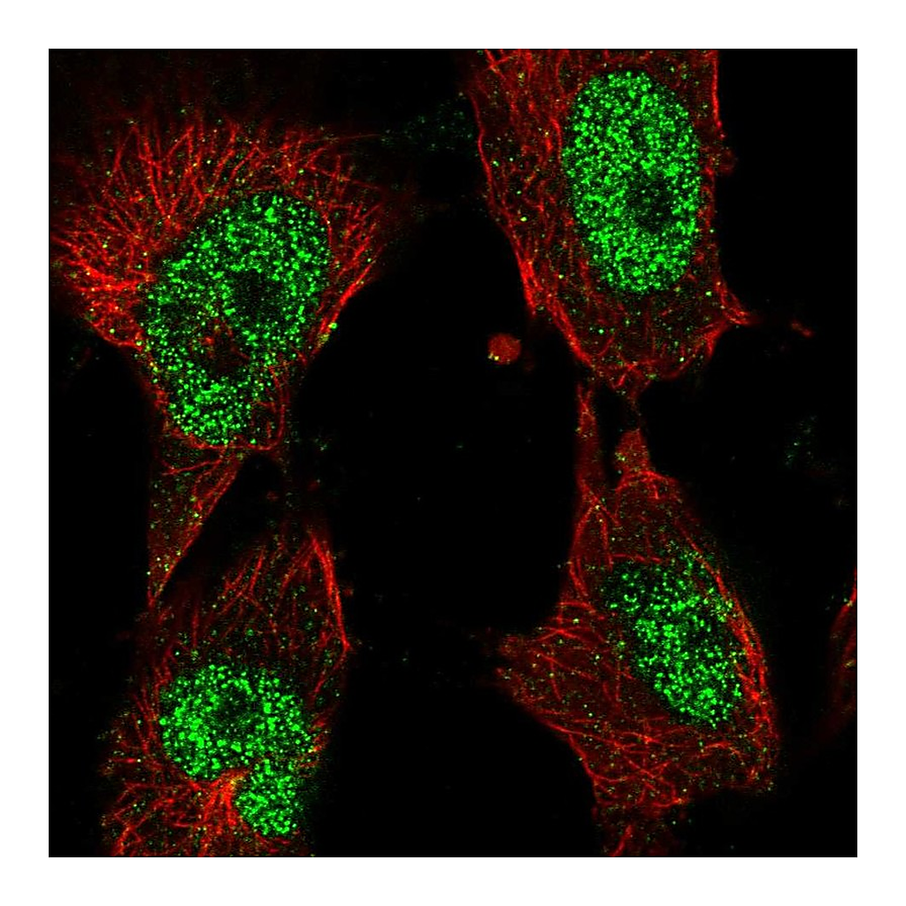 Atlas Antibodies Anti-POLK Antibody