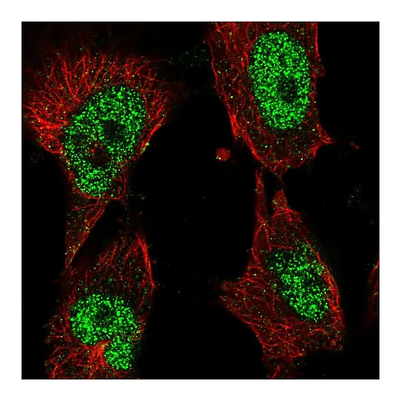 Atlas Antibodies Anti-POLK Antibody