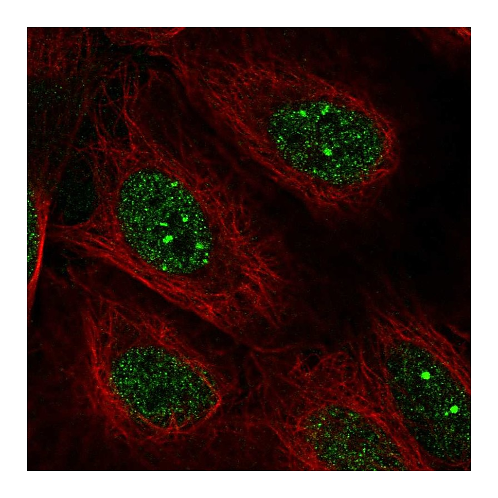 Atlas Antibodies Anti-POLK Antibody