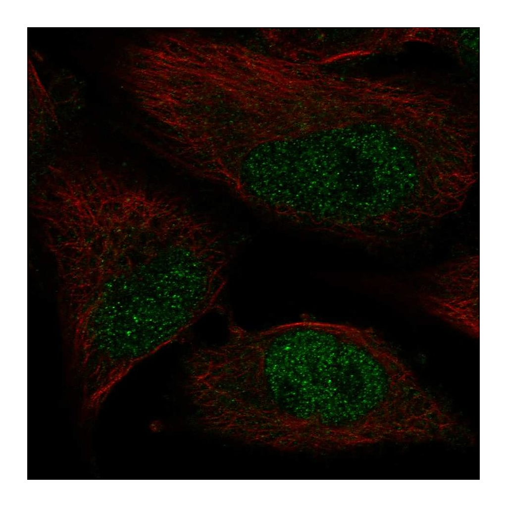Atlas Antibodies Anti-POLK Antibody