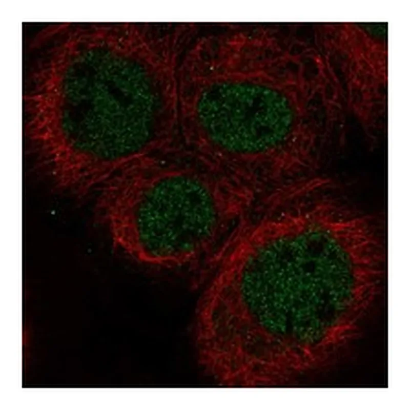 Atlas Antibodies Anti-POLL Antibody