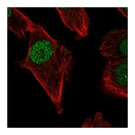 Atlas Antibodies Anti-POLM Antibody