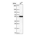 Atlas Antibodies Anti-POLM Antibody
