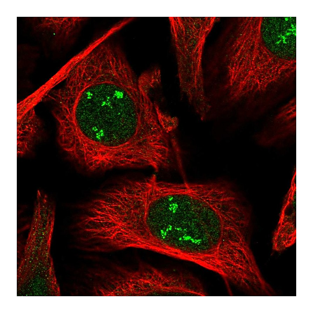 Atlas Antibodies Anti-POLR1A Antibody