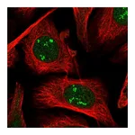 Atlas Antibodies Anti-POLR1A Antibody