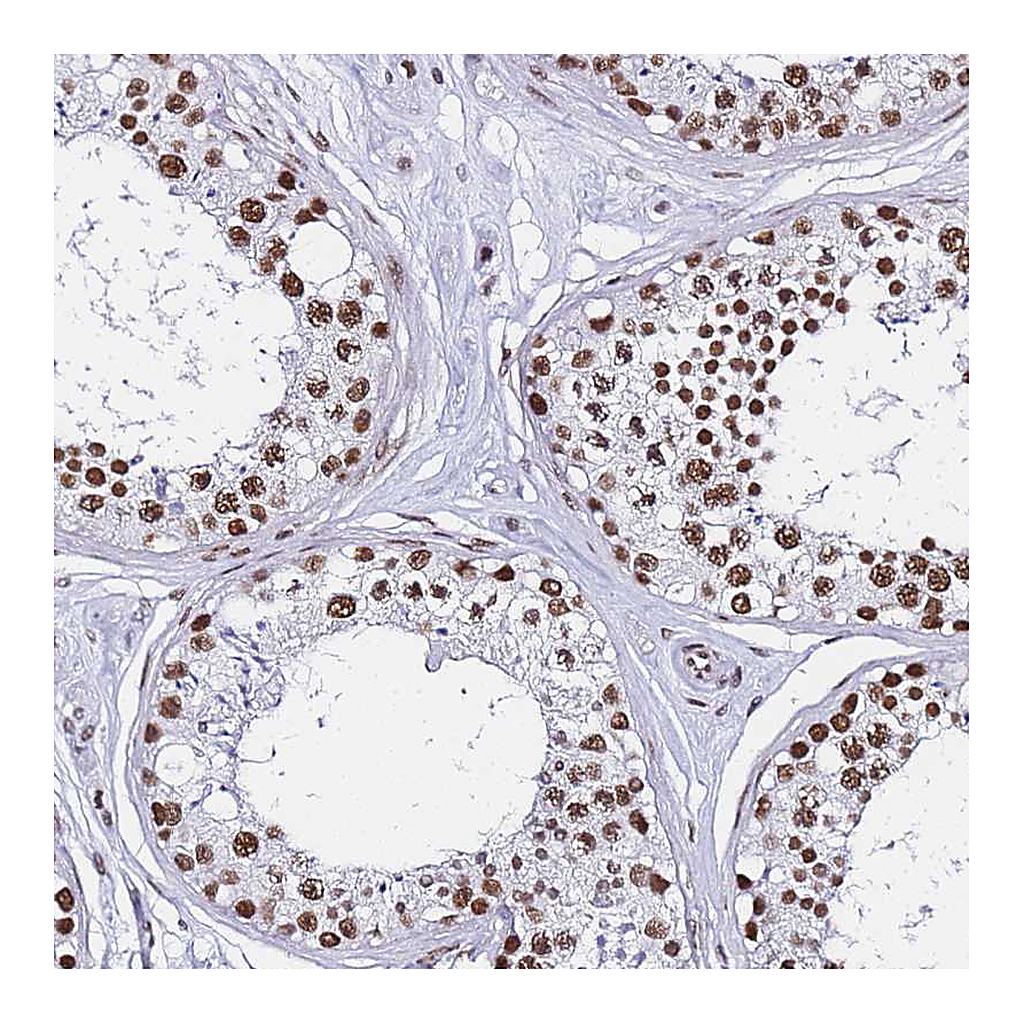 Atlas Antibodies Anti-POLR1A Antibody