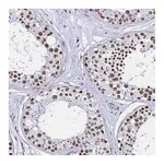 Atlas Antibodies Anti-POLR1A Antibody