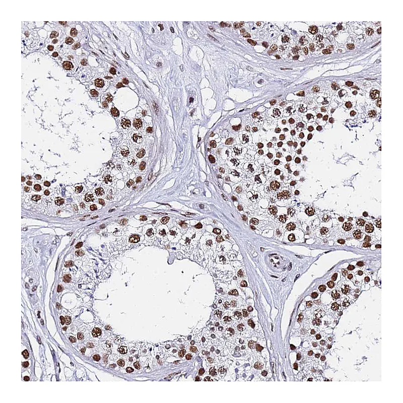 Atlas Antibodies Anti-POLR1A Antibody